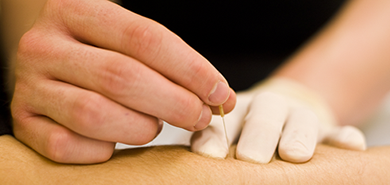 dry needling
